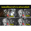 ไฟปักสนามโซล่าเซลล์ ทรงบอลกลม (แสง : เหลืองวอมไวท์)(1 แถม 1)